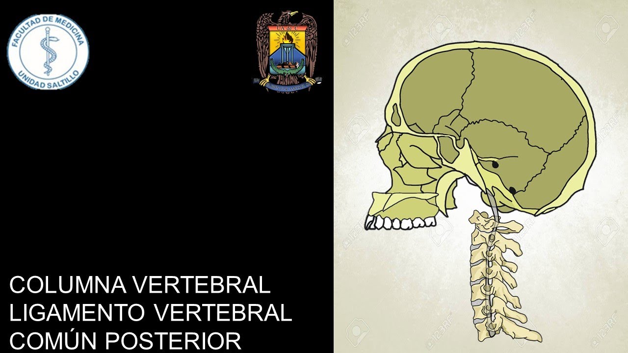 COLUMNA VERTEBRAL I: LIGAMENTO VERTEBRAL COMÚN POSTERIOR