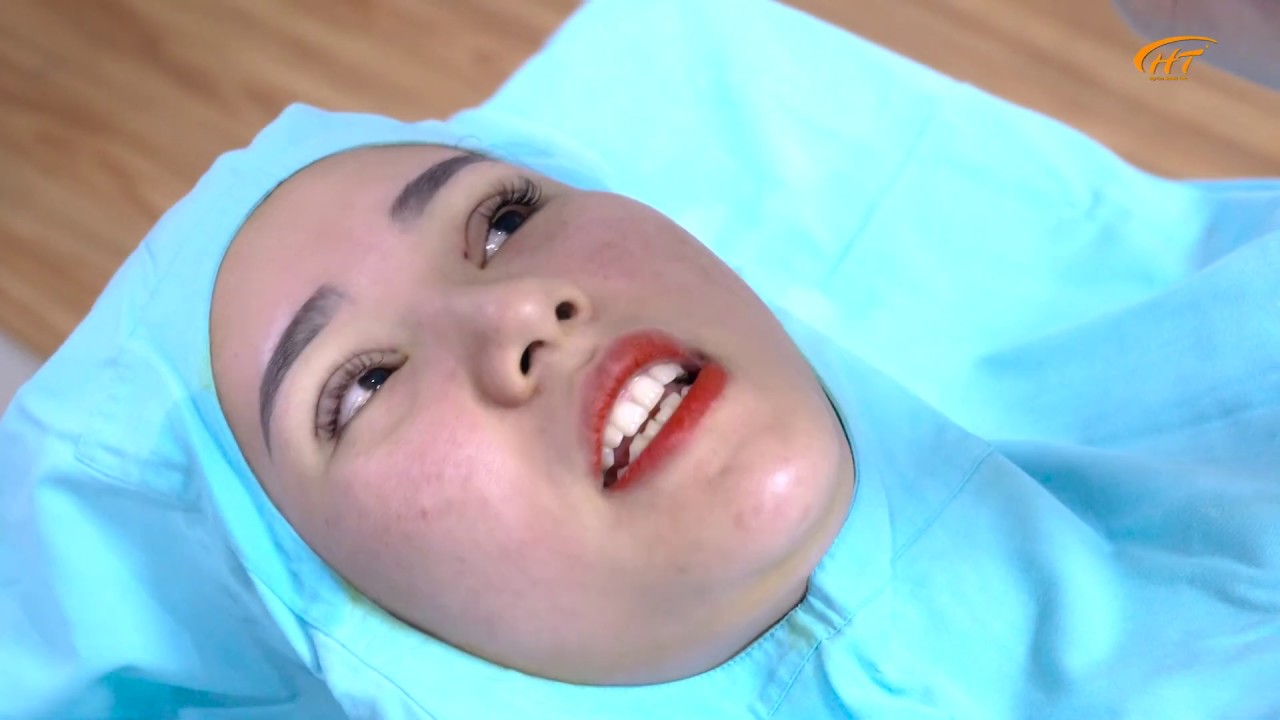Nhấn mí cho một vị khách đặc biệt! | Dr Hoàng Tuấn