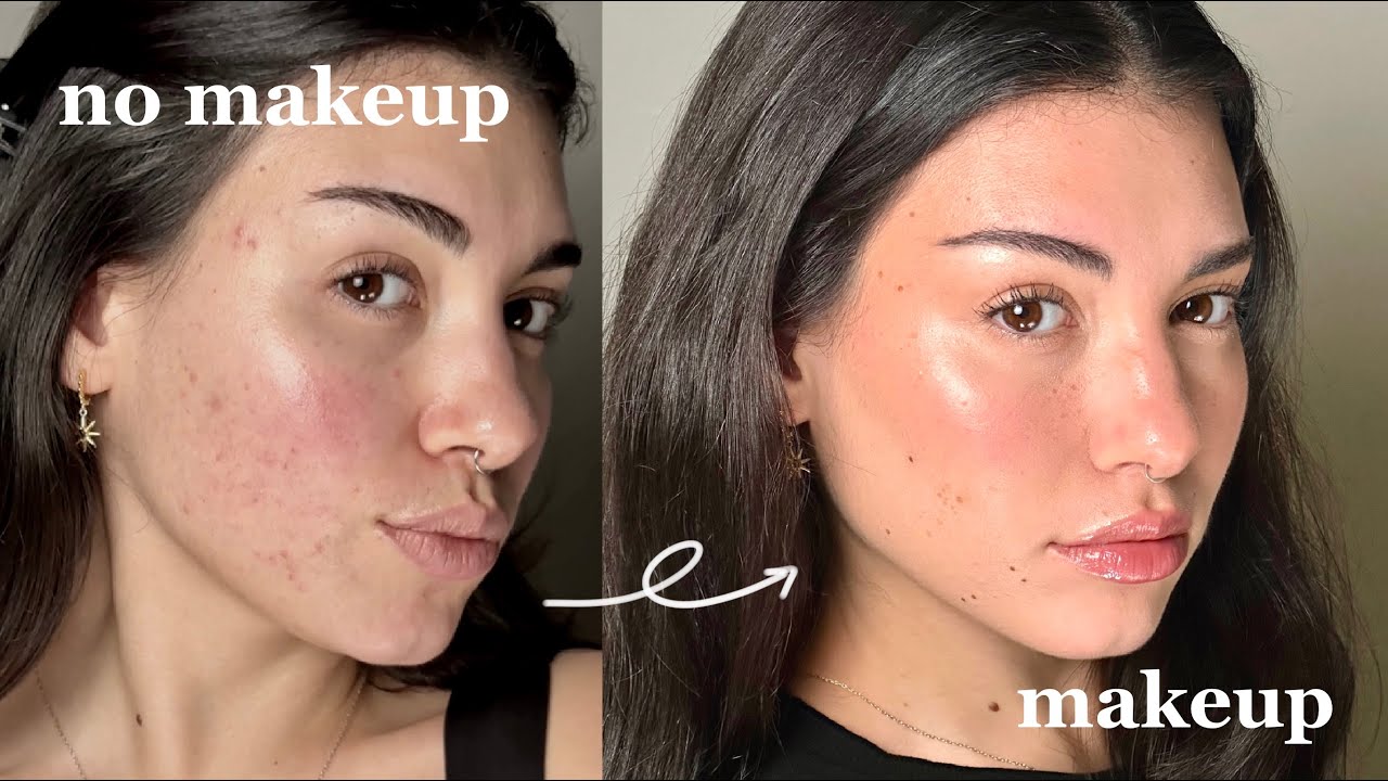 how to fake perfect skin with makeup | acne friendly