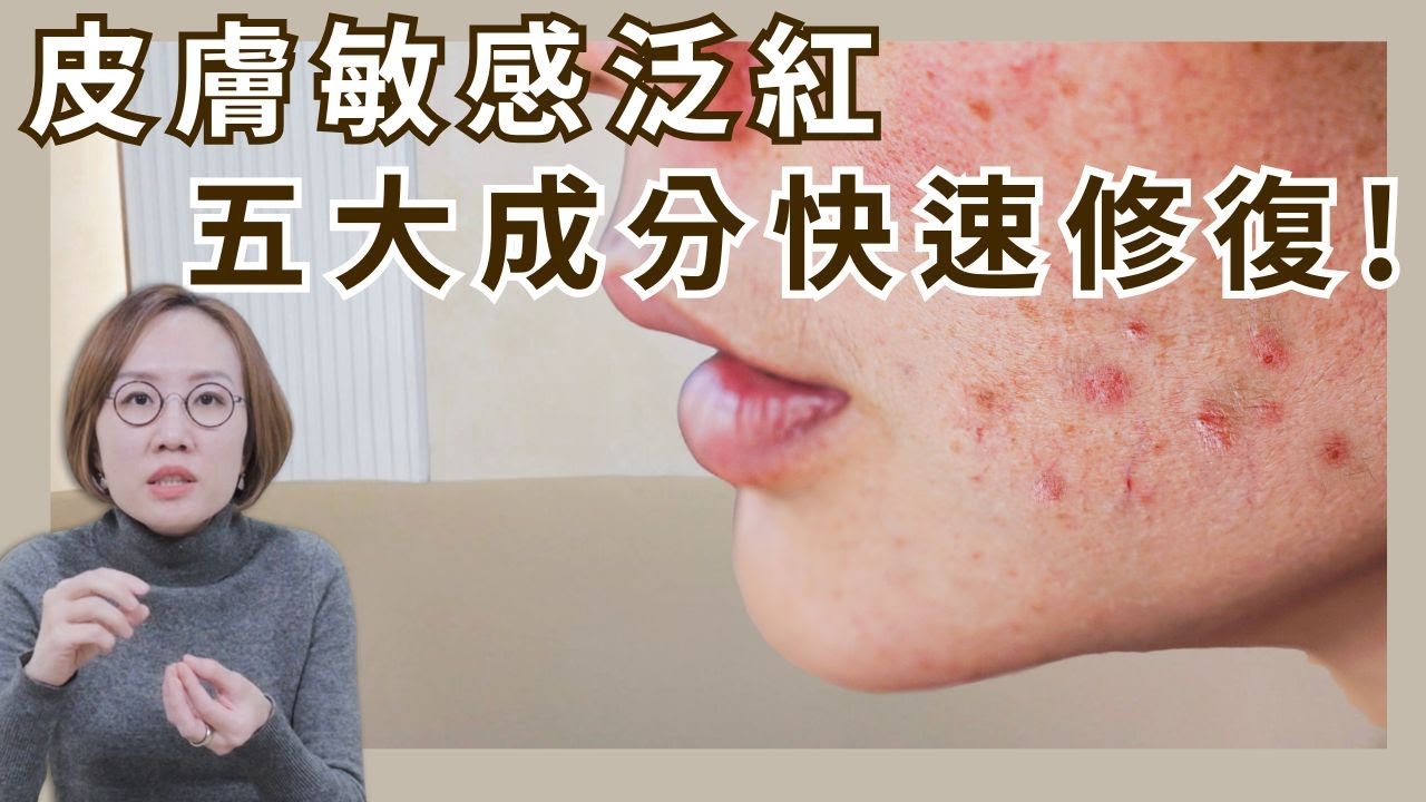 皮膚泛紅、敏感肌，如何快速舒緩及修復？皮膚科告訴你，五大修復成分！