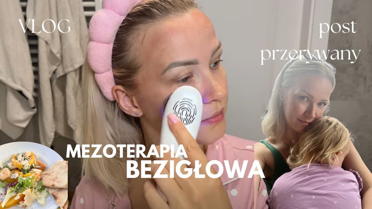 vlog | mezoterapia bezigłowa skinlovers | efekty po 1 miesiącu postu przerywanego | zepsute auto