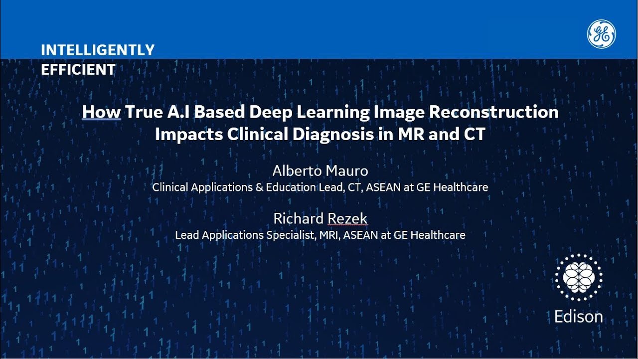 How True A.I based Deep Learning Image Reconstruction Impacts Clinical Diagnosis in MR & CT
