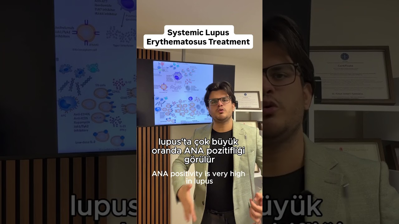 Sistemik lupus eritematosis SLE ANA antikoru