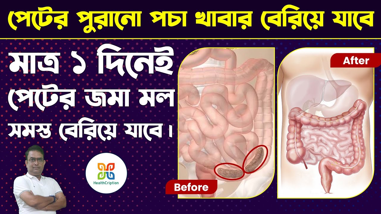 ১চামচে পেটের সব ময়লা পরিষ্কার হবে |3 Effective Home Remedies for Constipation.colon detoxification.