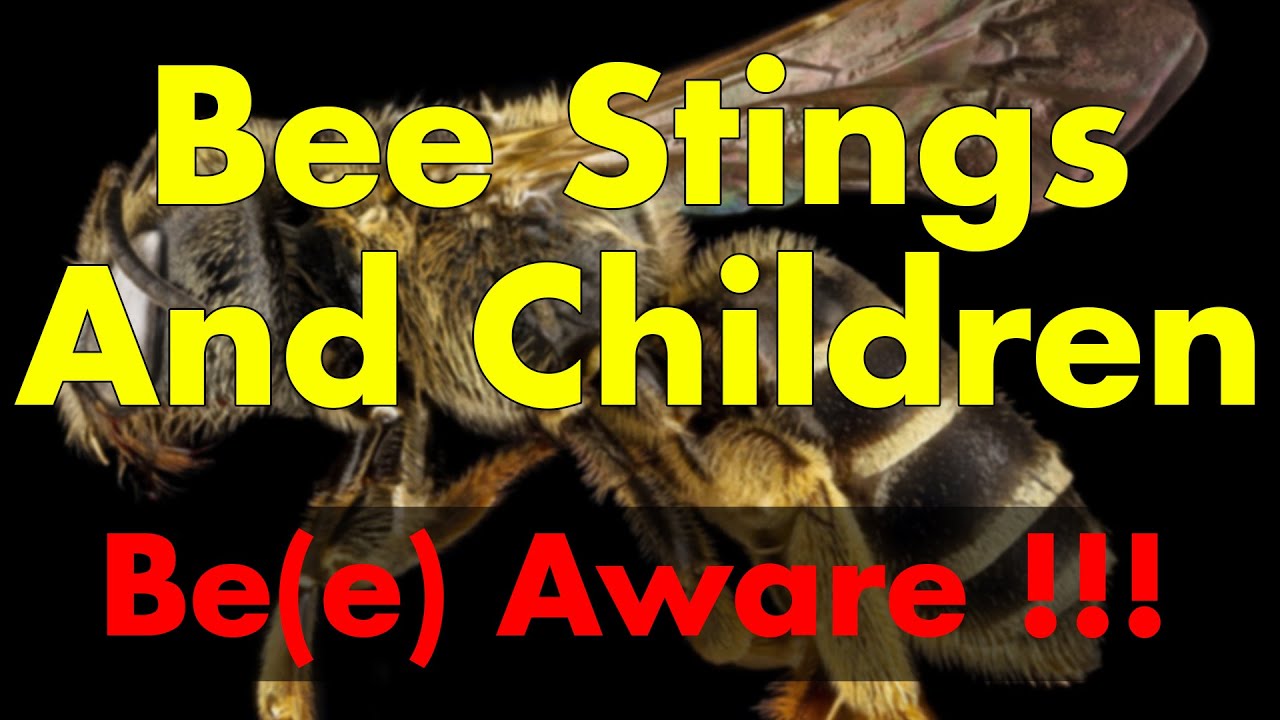 Bee Stings and Children 🐝 | Be(e) Aware !!! 🛑 | Child Health