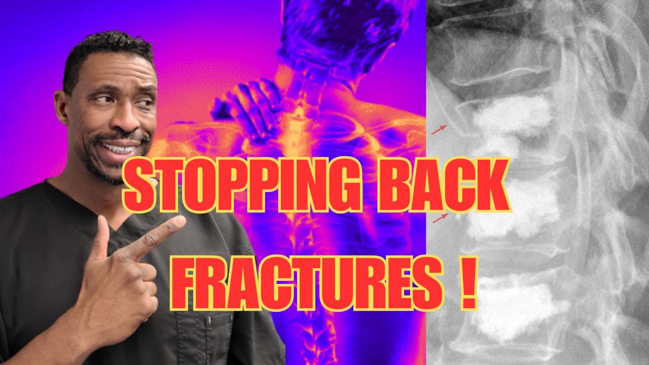 After One Compression Fracture , How To STOP More From Happening