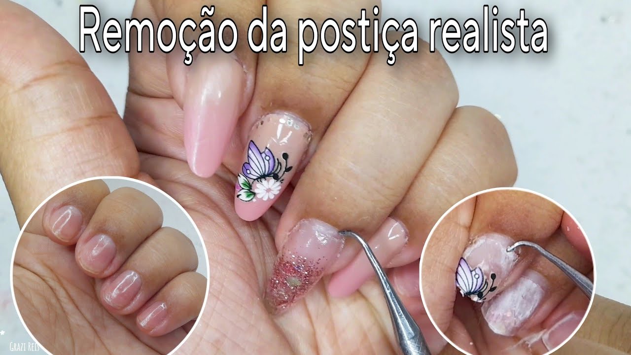 COMO REMOVER AS POSTIÇA REALISTA!