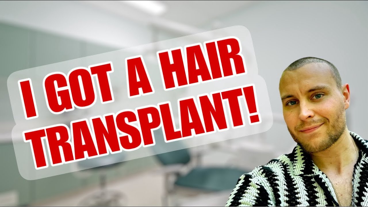 HAIR TRANSPLANT in Istanbul 2024! My Experience…