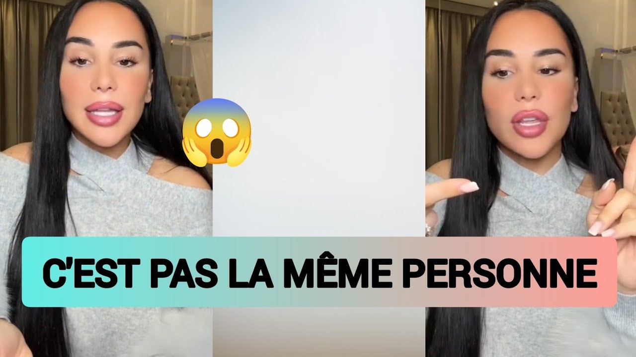 Milla Jasmine is angry about the before-surgery photos circulating on social media.