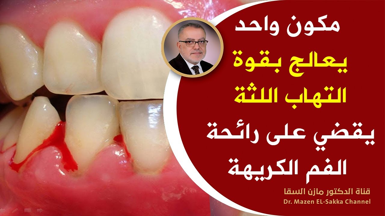 ضعها على اللثة يوميا النتيجة سوف تبهرك لثة وردية دون التهاب تعالج رائحة الفم الكريهة وامراض اللثة