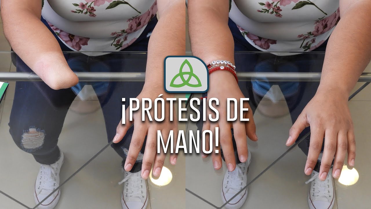 Prótesis de mano / Hand prosthetic (4K Ultra Full HD) No 232