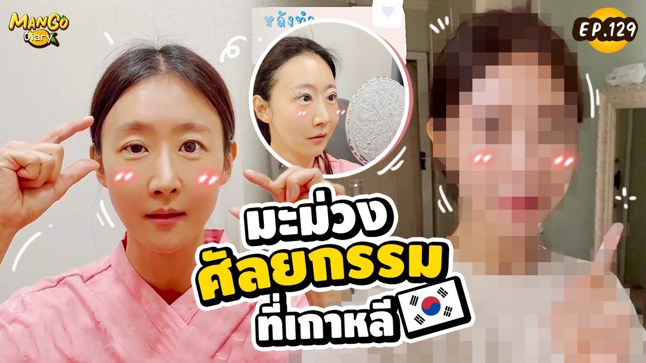 มะม่วงไปศัลยกรรมเกาหลี ศัลยกรรมอะไรบ้าง พักฟื้นกี่วัน!? | Mango Diary Ep.129