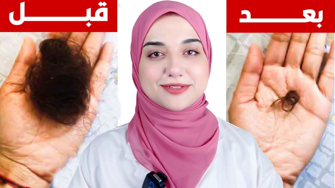 وصفة ببلاش لتطويل الشعر و ايقاف التساقط و انبات الفراغات و التخلص من القشرة نهائيا