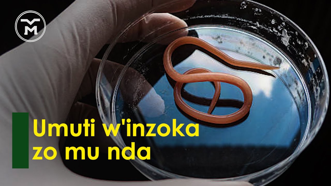 00171: UMUTI WO MU NDA || UVURA INZOKA ZINYURANYE || UBWOKO BWAWO || UKO UKORESHWA || ICYITONDERWA