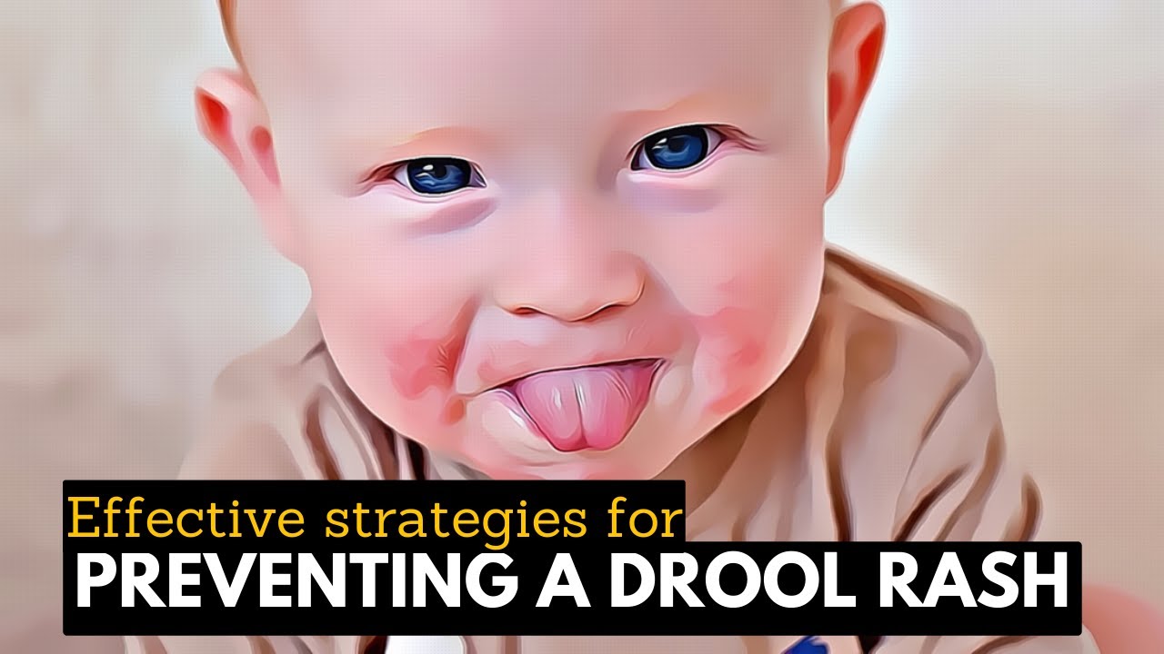From Irritation to Radiant Skin: Managing Drool Rash with Care