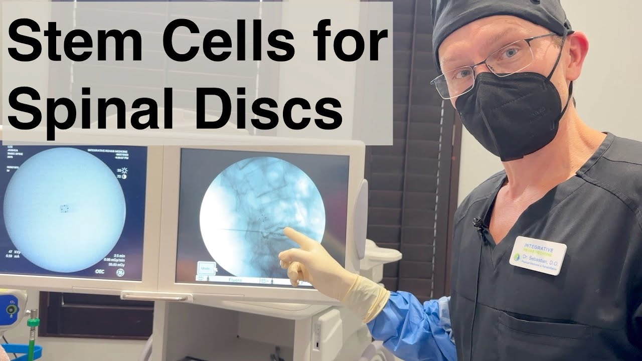 Treatment of Back Pain from Lumbar Discs with Bone Marrow Stem Cells