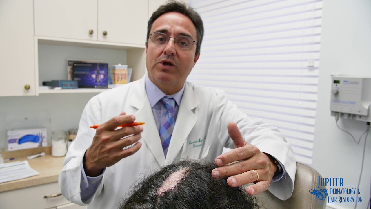 Surgical Options for Lichen Planopilaris, Scarring Alopecia & Lupus