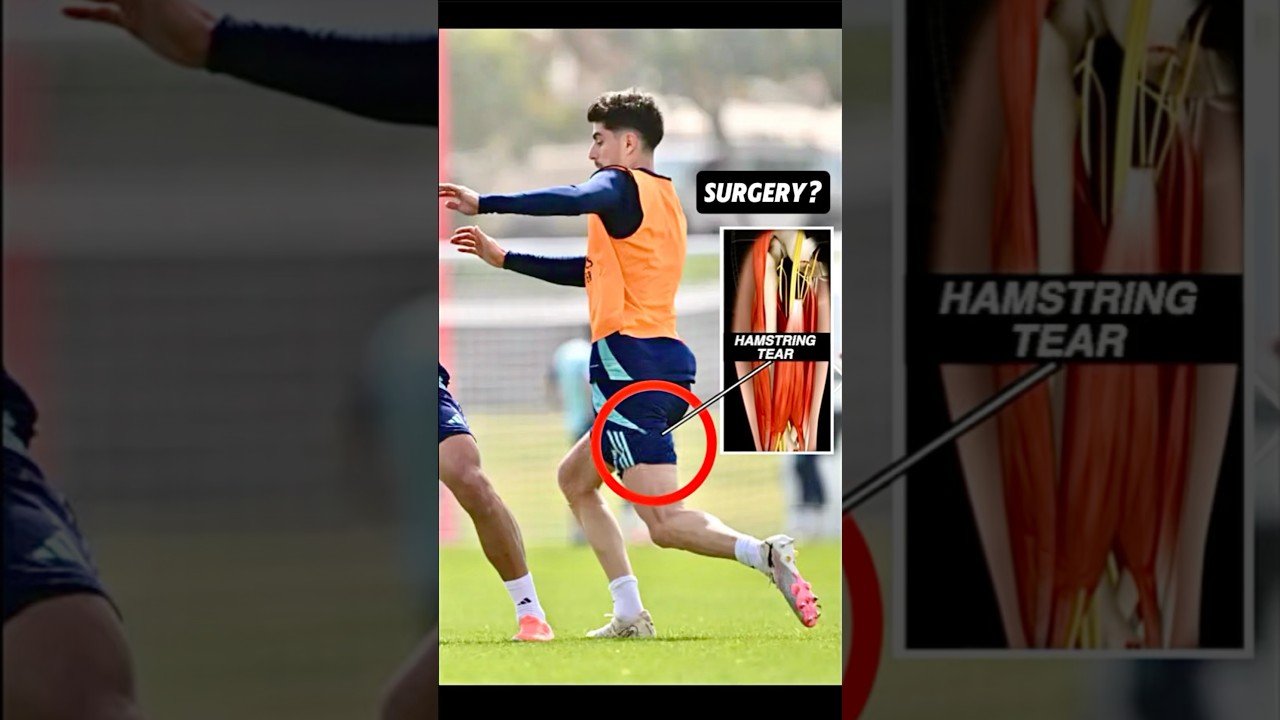 Doctor explains Kai Havertz surgical hamstring injury #Arsenal #KaiHavertz #Anatomy #PremierLeague
