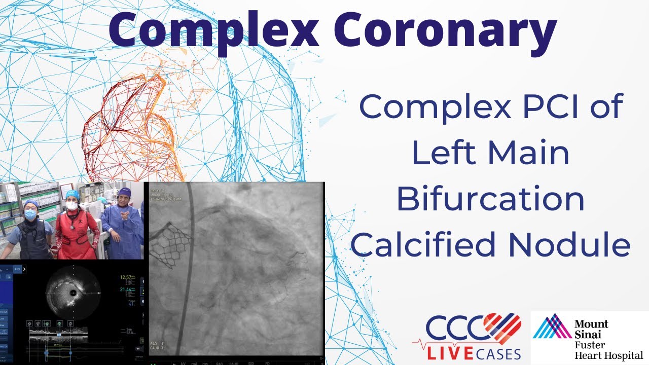 Complex PCI of Left Main Bifurcation Calcified Nodule