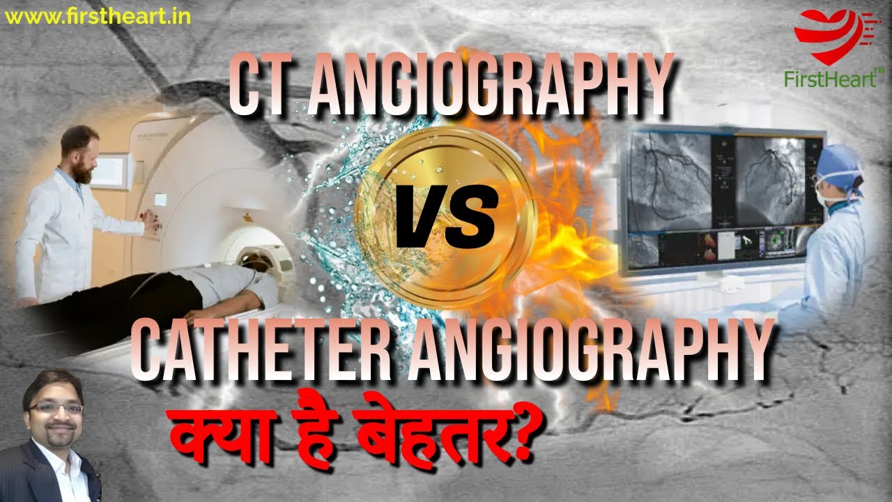 सीटी एंजियोग्राफी या कैथेटर एंजियोग्राफी. क्या है बेहतर? CT or catheter angiography. What is best?