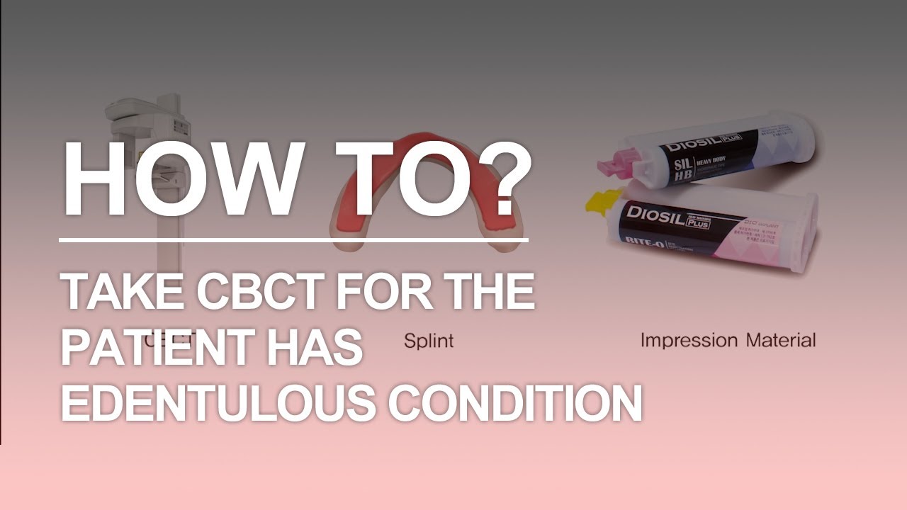 Take CBCT for edentulous condition (DIOnavi. Learning Contents)