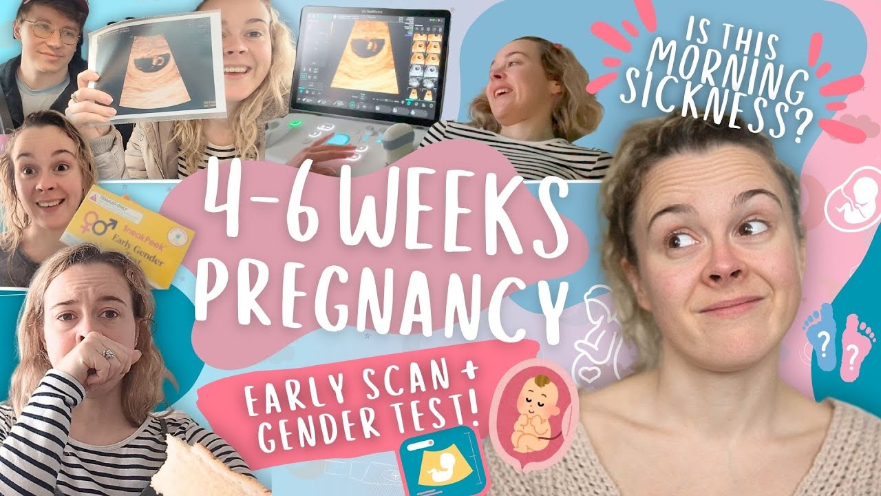 EARLY SCAN, Sneak Peek GENDER TEST... And morning sickness already?!  (The Baby Diaries: Chapter 4)
