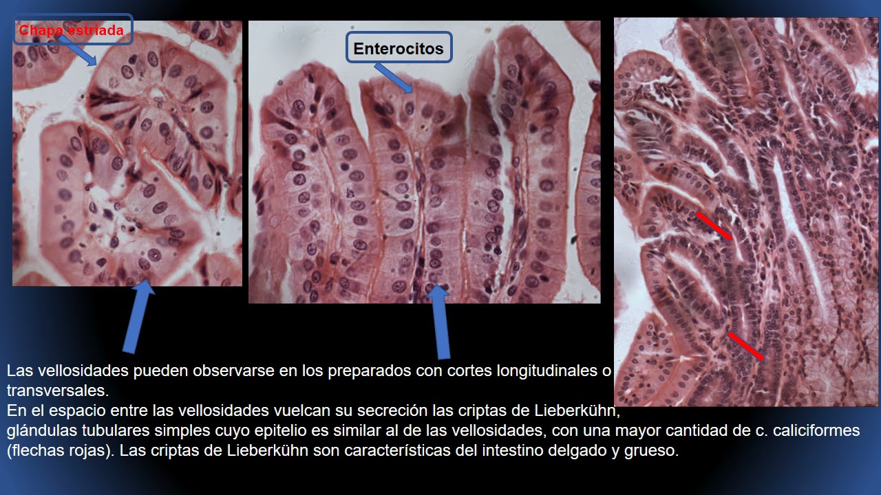 Mucosa del Intestino delgado