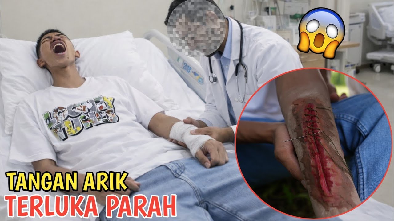TANGANYA ARIK TERLUK4 PAR4H SAMPE HARUS DIAMPUT4SI??😱KASIHAN | Mikael TubeHD