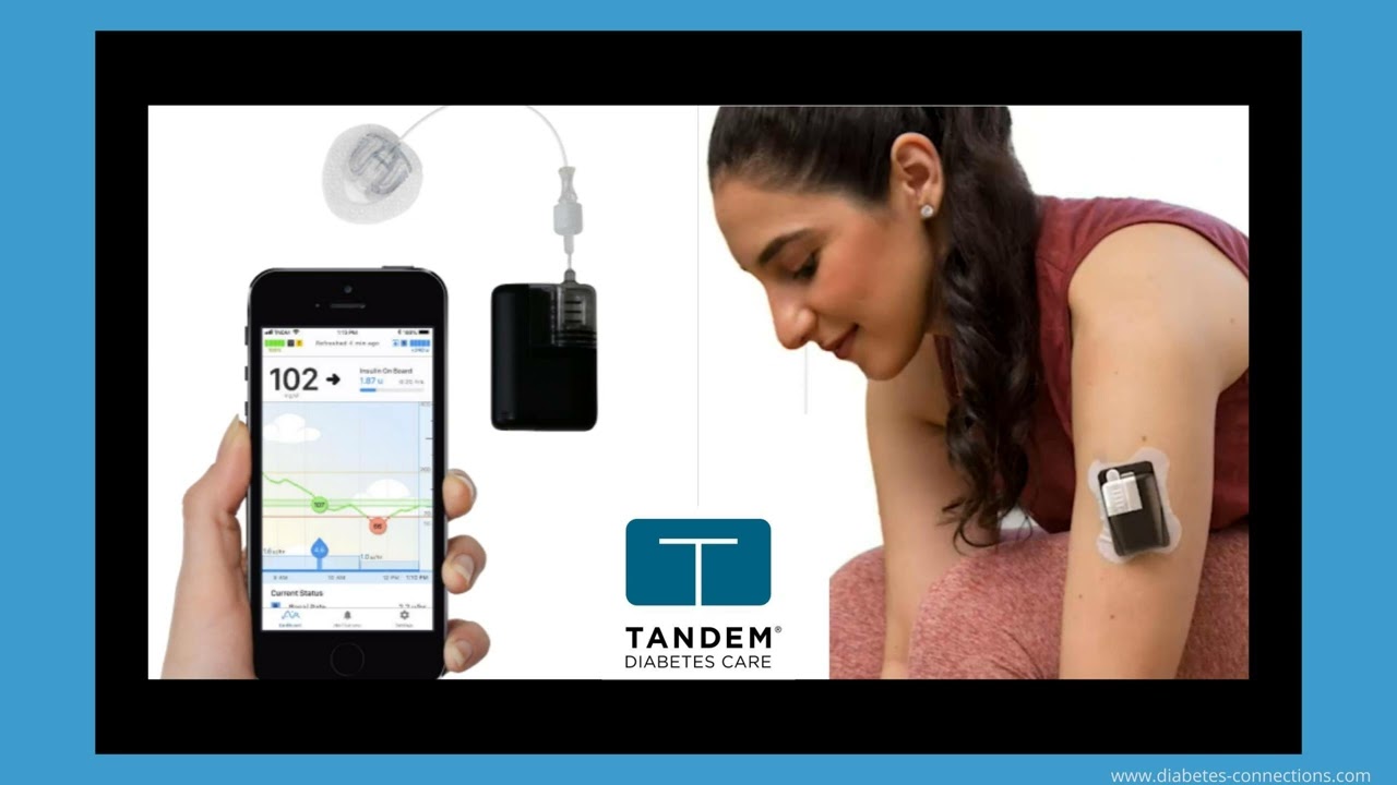 Smaller, Smarter, & More Flexible: A look into Tandem's product pipeline