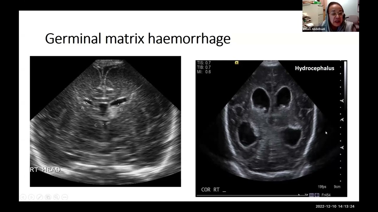 Topics in Paediatric Emergencies:  Imaging in Neonatal & Paediatric Emergencies- Dr Inaam Abdel Hadi