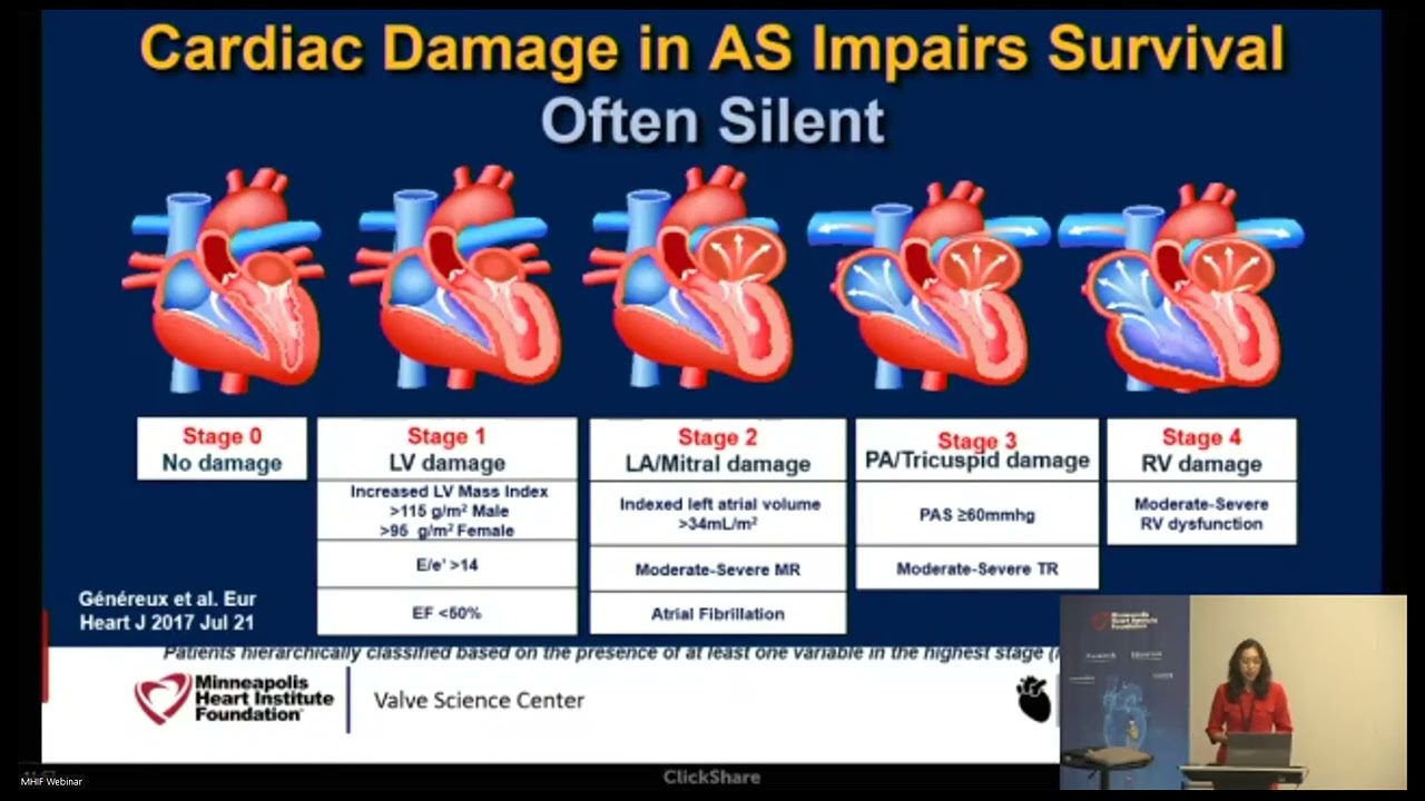 Clinical Impact of 