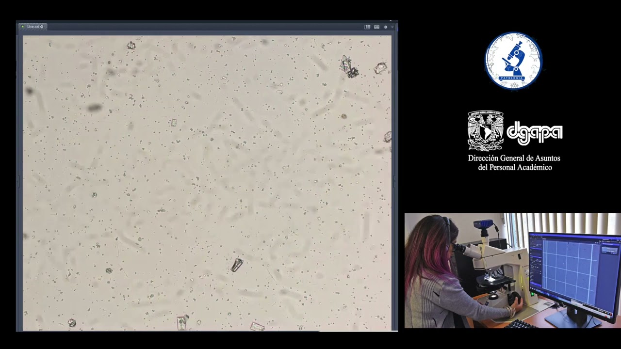PRÁCTICA 15. EXAMEN MICROSCÓPICO DE LA ORINA.