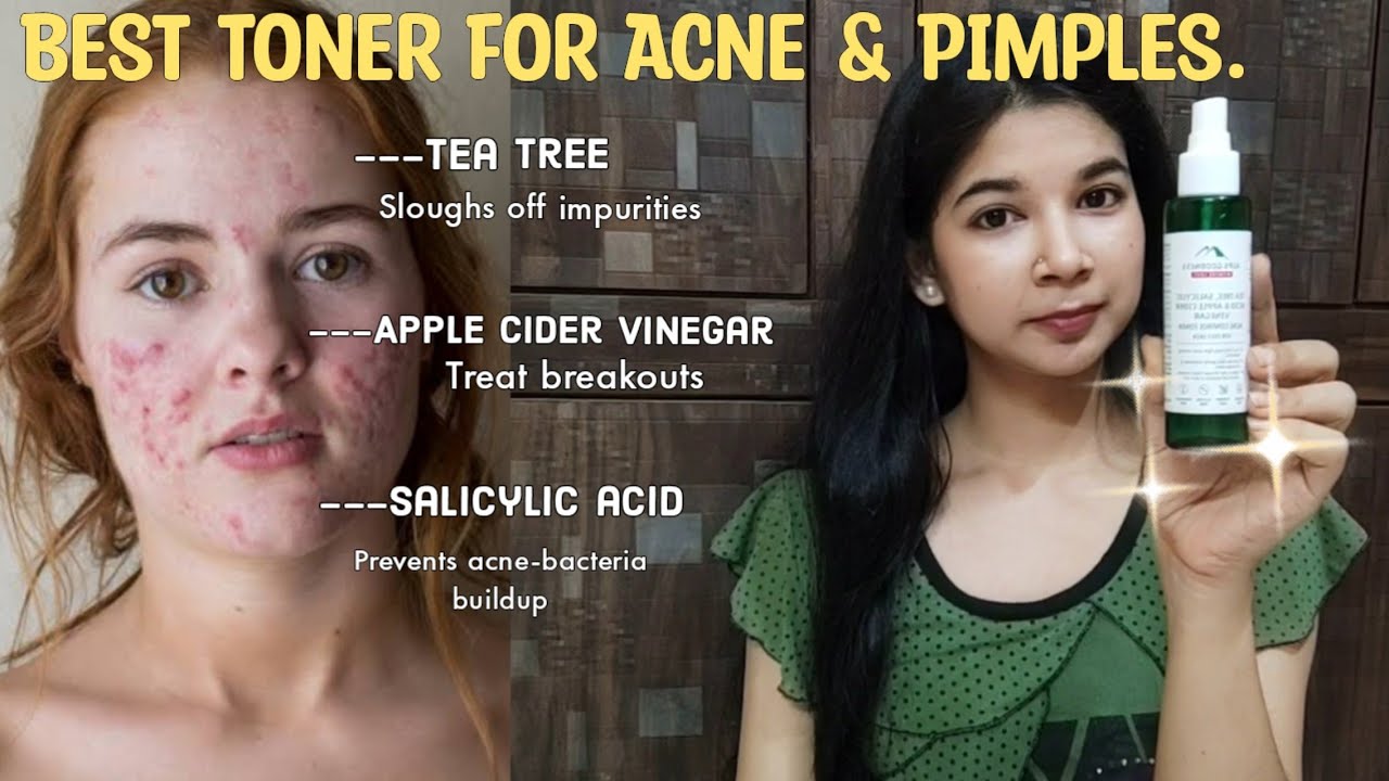 Alps Goodness Tea Tree, Salicylic Acid & Apple Cider Vinegar Toner Review/Best Toner For oily skin/