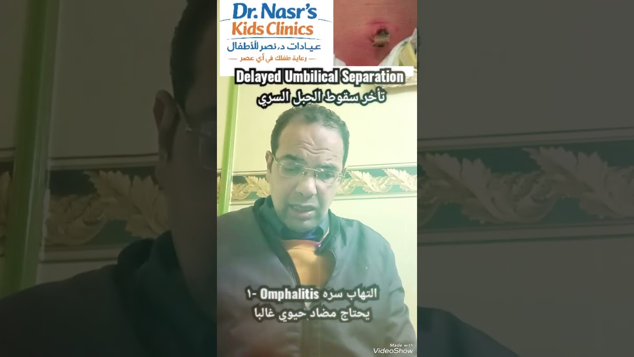 #dr_nasr_kids_clinics تأخر سقوط الحبل السري Delayed Umbilical Separation 