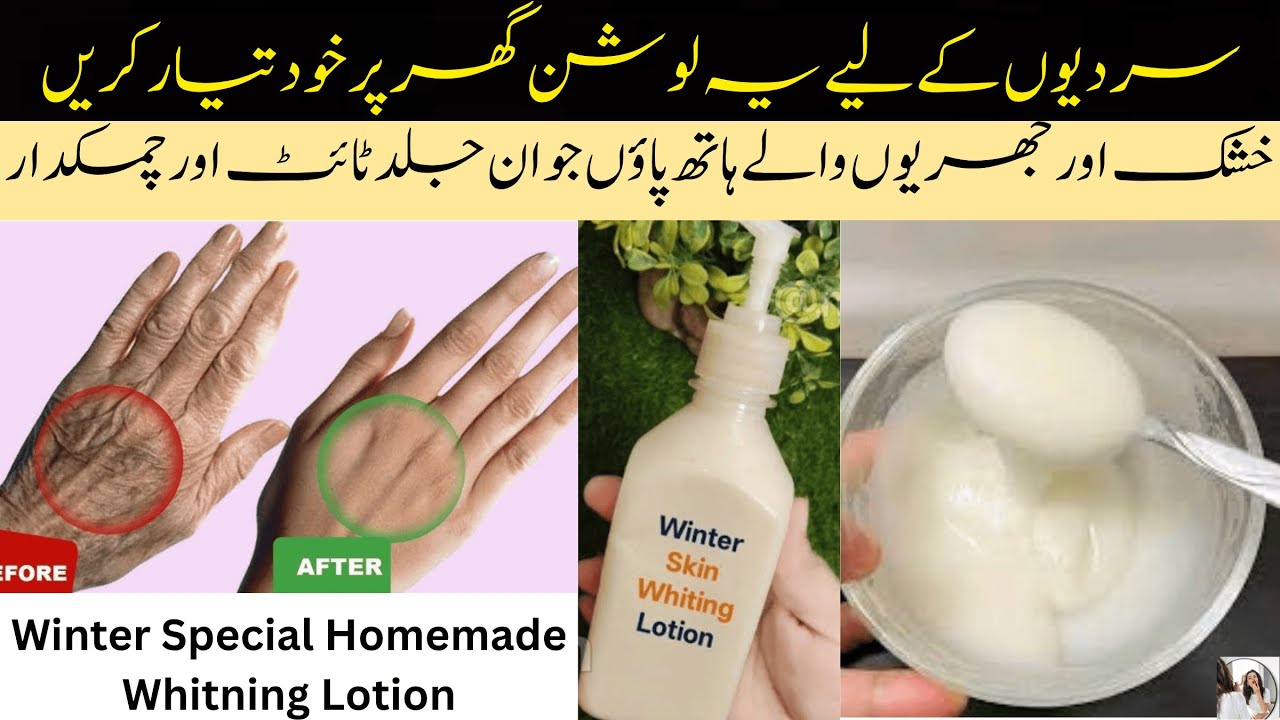 Diy Winter Special Anti-aging & Skin Brightening Alum Homemade Lotion | Hand & Feet Whitening Lotion