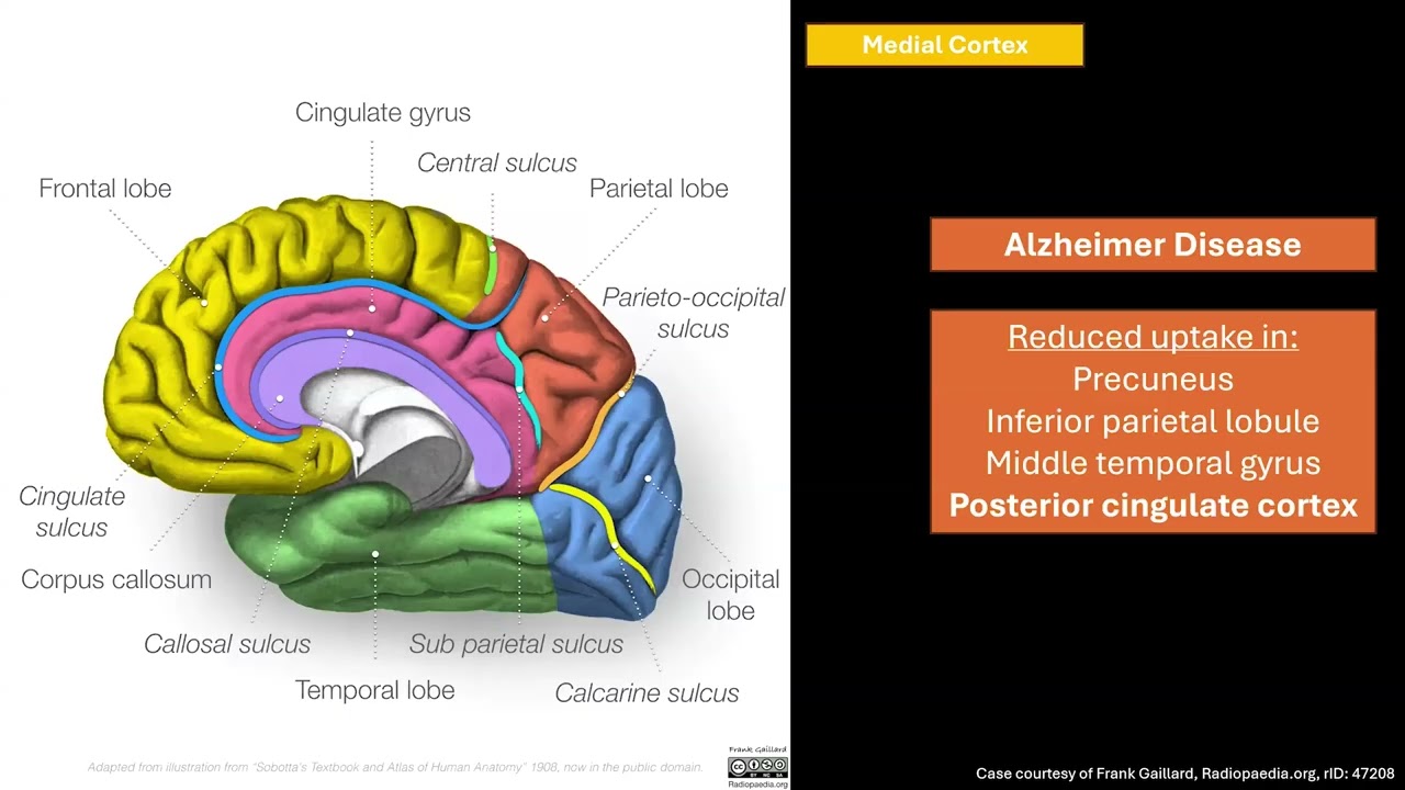 Introduction to PET Imaging of the Brain w/ Dr. Sally Ayesa | Medality / MRI Online Radiology Course
