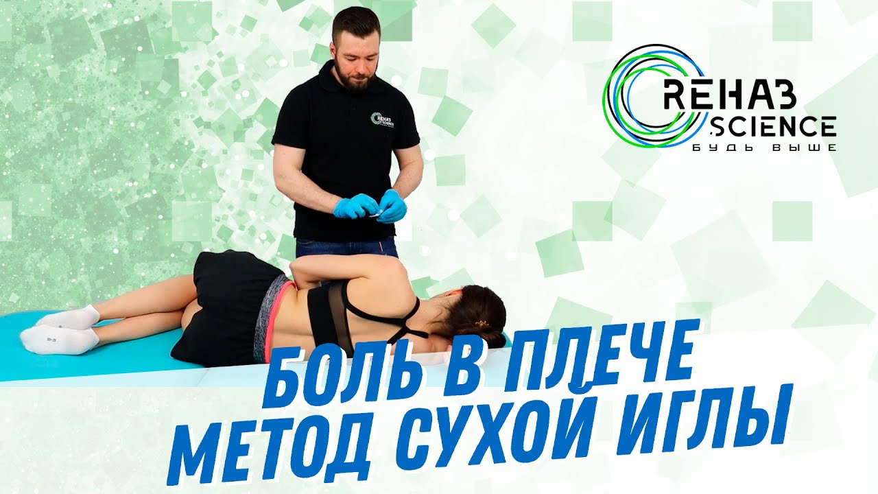 Дельтовидная мышца на боку. Сухие иглы