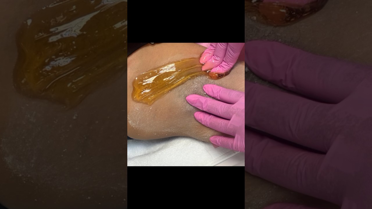 SUGARING UNDERARM | SUGAR WAX 🍯 #sugarwaxing #esthetician #sugarslime