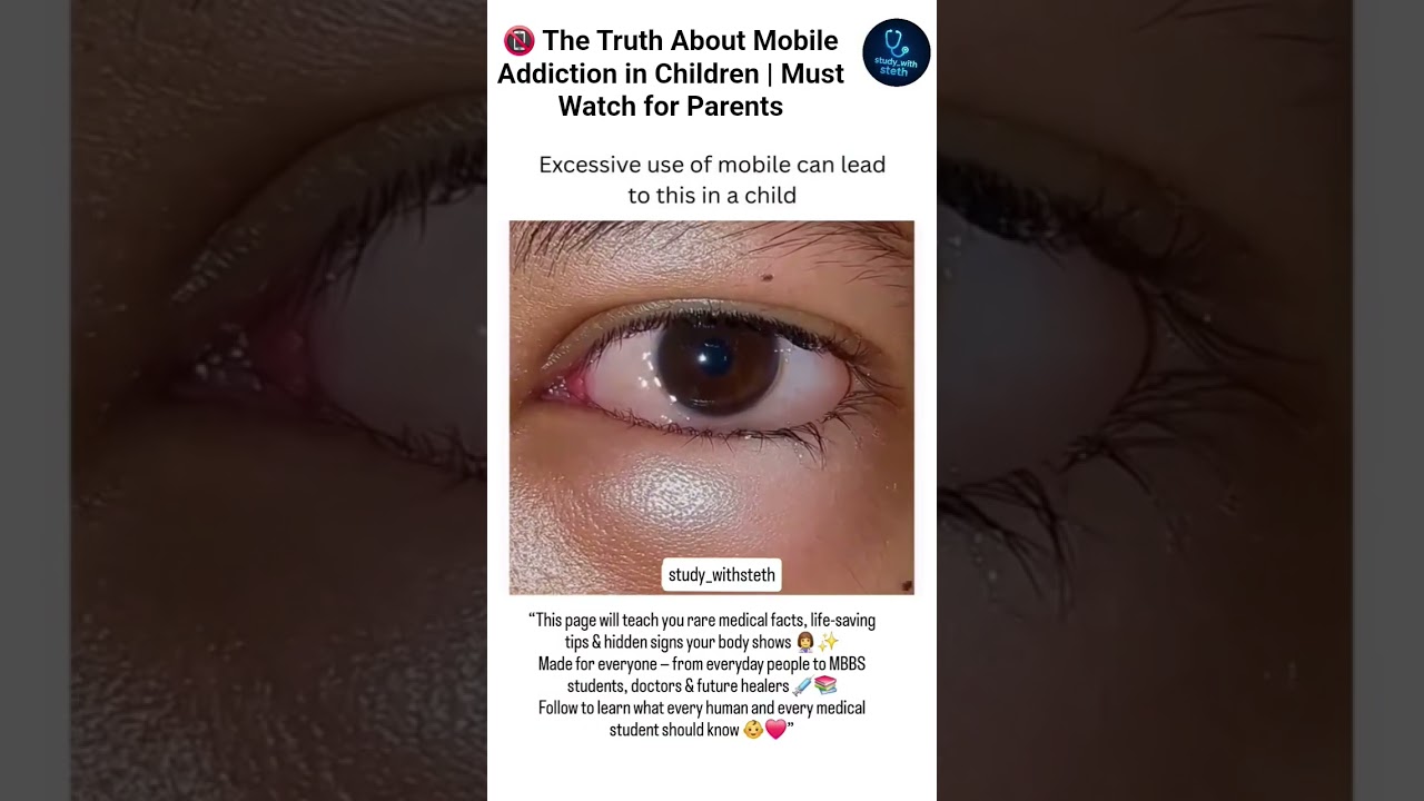 📱 Excessive Mobile Use Can Harm Children ⚠️ | Parenting Awareness