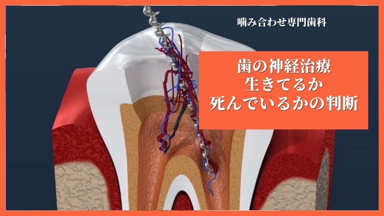 歯の神経が生きているか死んでいるかの判断