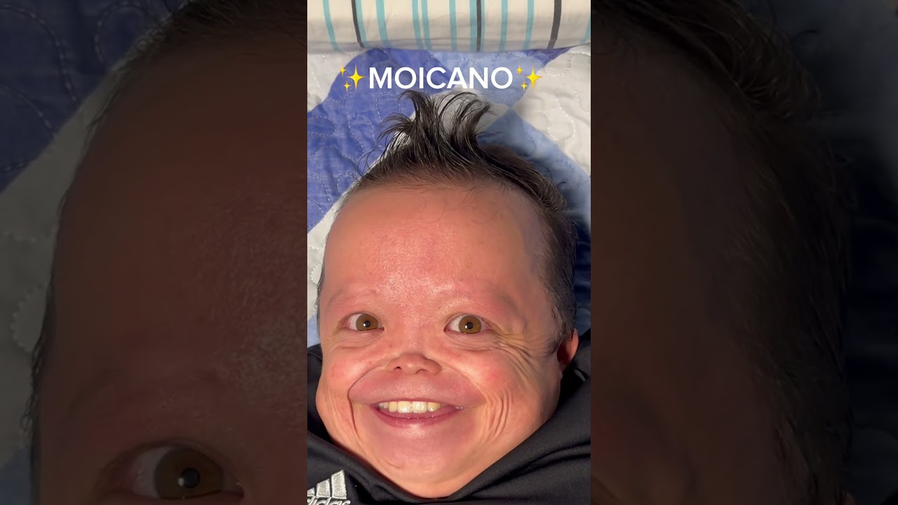 Peinas para ni&ntilde;os de 3 meses 🤣🤣 #humor #comedia #juanchi #juanchinbrodie