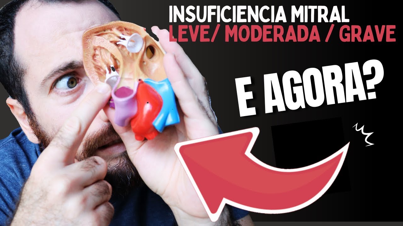 insuficiencia mitral leve, moderada ou grave, qual delas devo tratar?