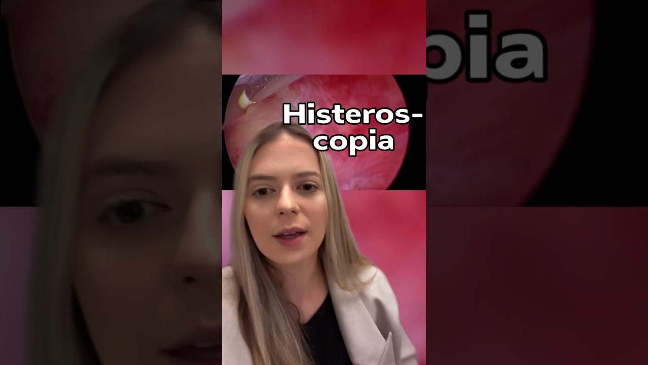Histeroscopia #infertilidade #miomauterino #polipoendometrial #histeroscopia #ginecologista