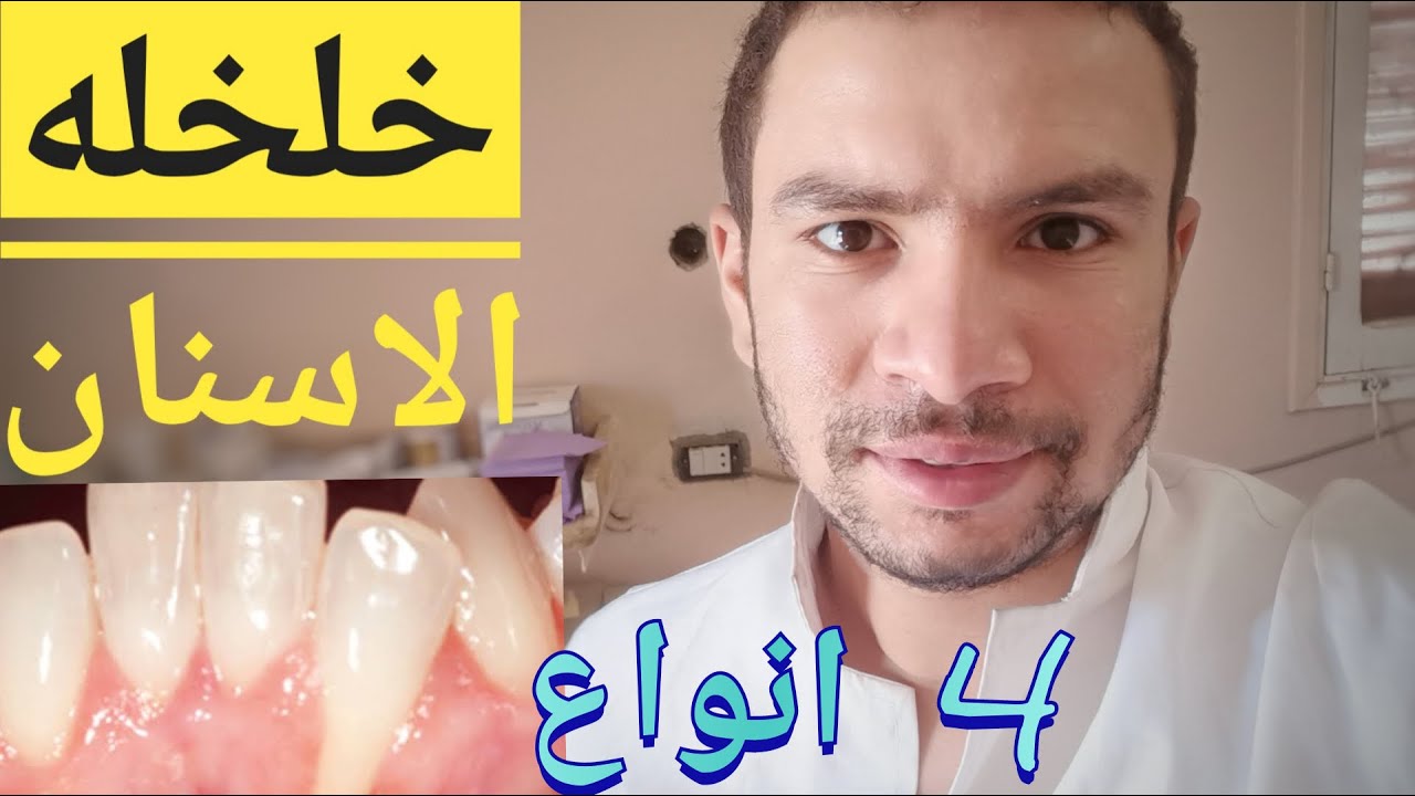 انواع خلخله الاسنان اعرف انت انهي نوع فيهم و ما مدى خطورته