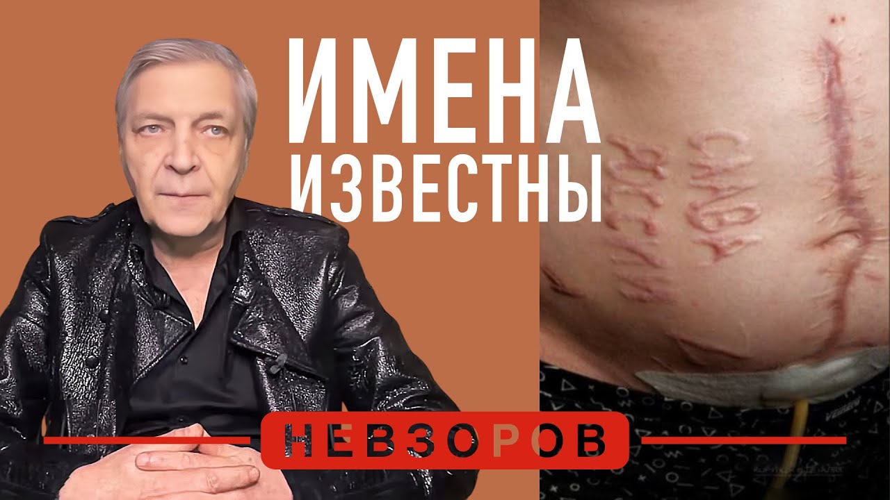 Россия — страна невозможного: врачи-выжигатели, следователи-мучители #невзоров