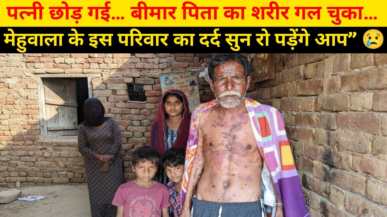 पत्नी छोड़ गई… बीमार पिता का शरीर गल चुका… मेहुवाला के इस परिवार का दर्द सुन रो पड़ेंगे आप” 😢