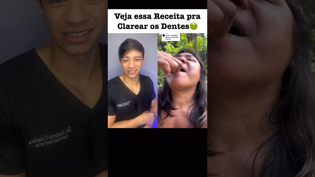 Rapaz Revela Segredo do Pai pra Clarear os Dentes. O Resultado foi esse&hellip; #shortssprintbrasil