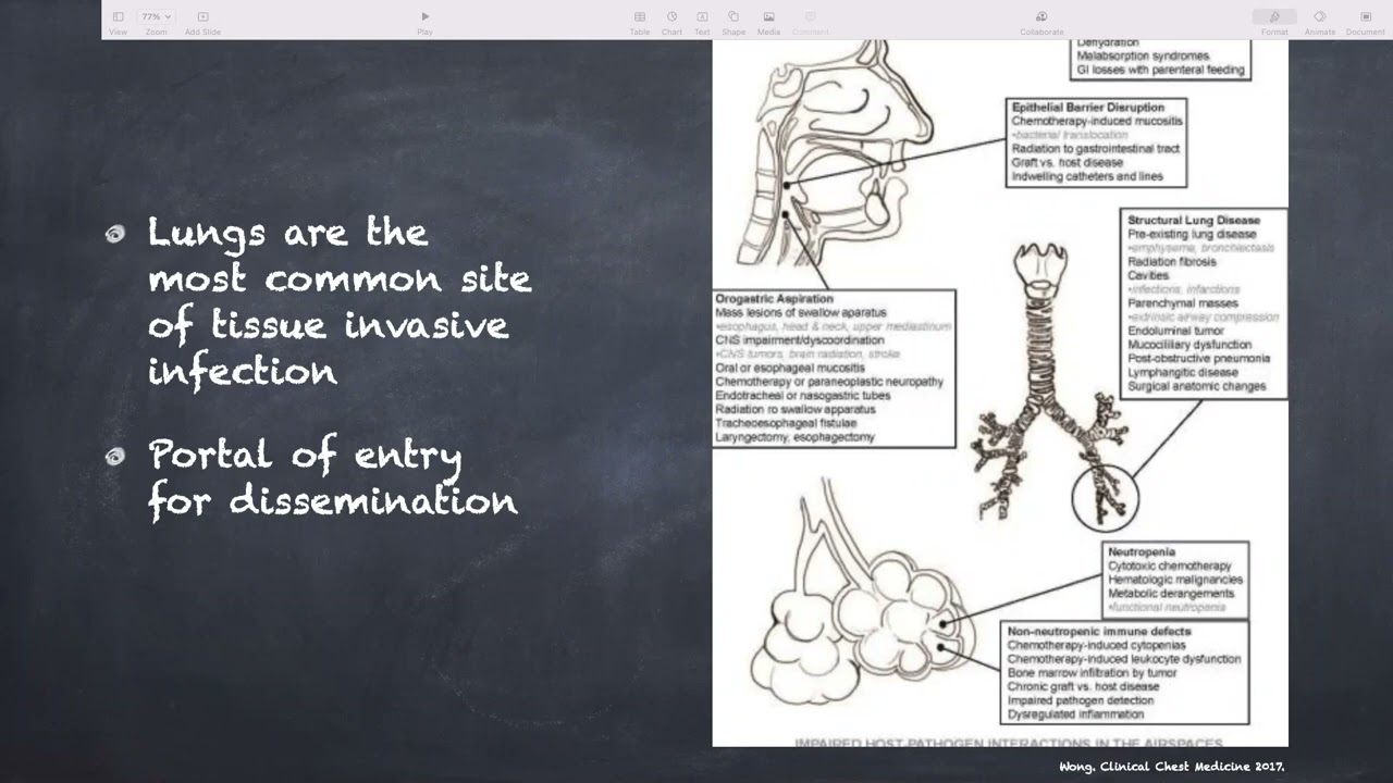 3/25/22- Pulmonary Complications of Hematopoietic Stem Cell Transplantation-- Dr. R. Sharma