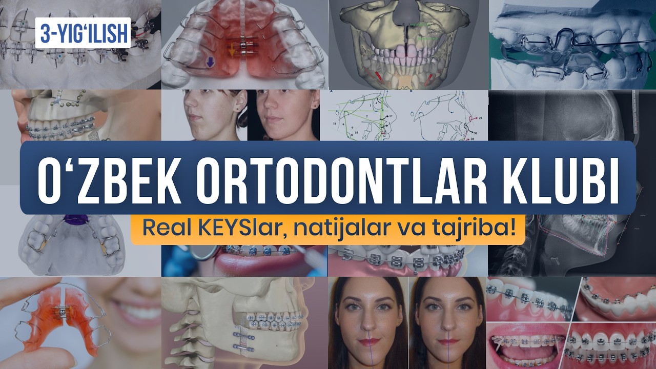 O'zbek ortodontlar klubi | 3-yig'ilish