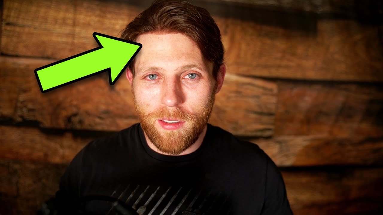 Can Hair System Be 100% Undetectable? Rapid Fire Hair System Viewer Questions!